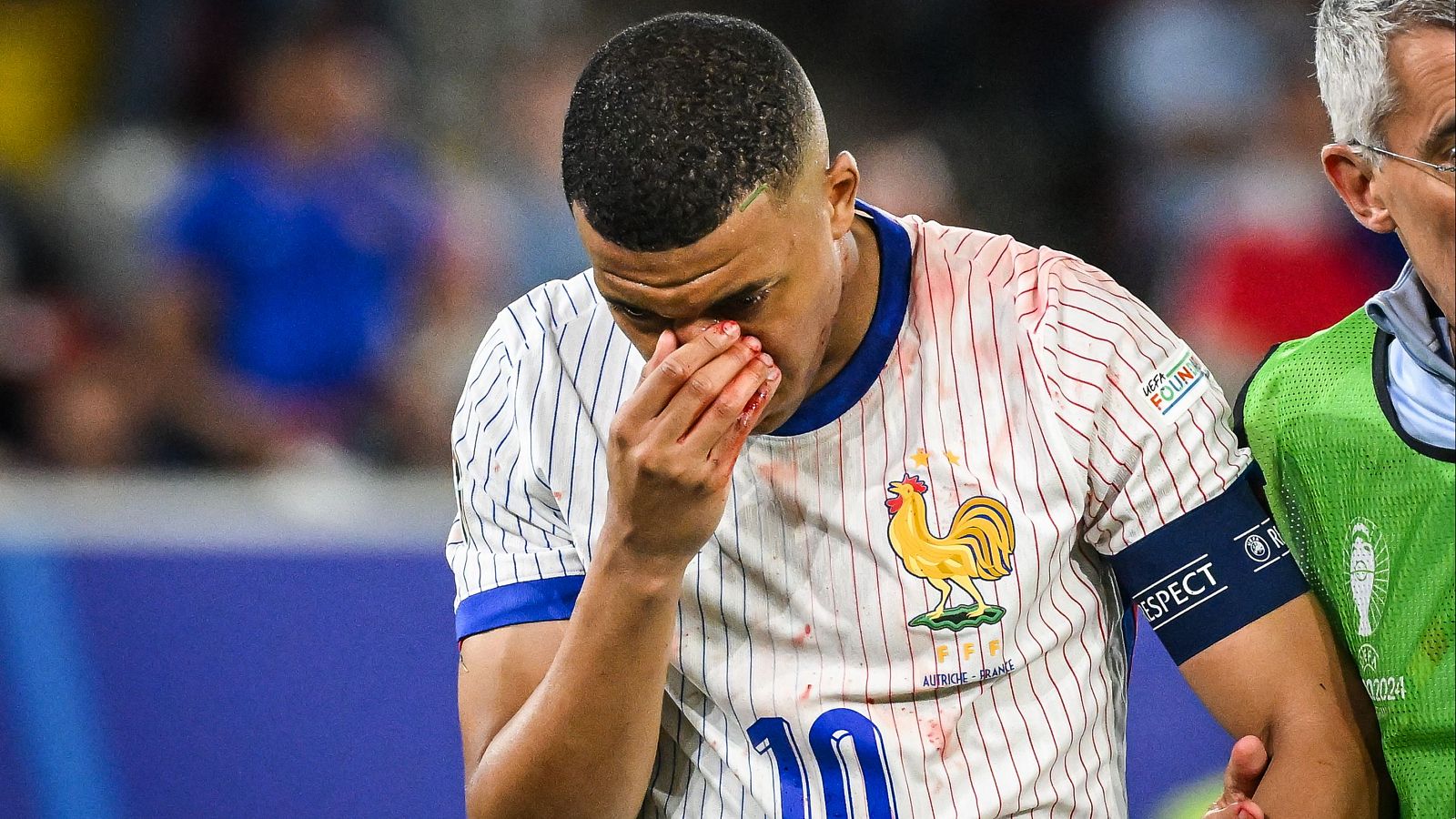 Mbappé se rompe la nariz al chocar contra el hombro de Danso - Eurocopa | Ver