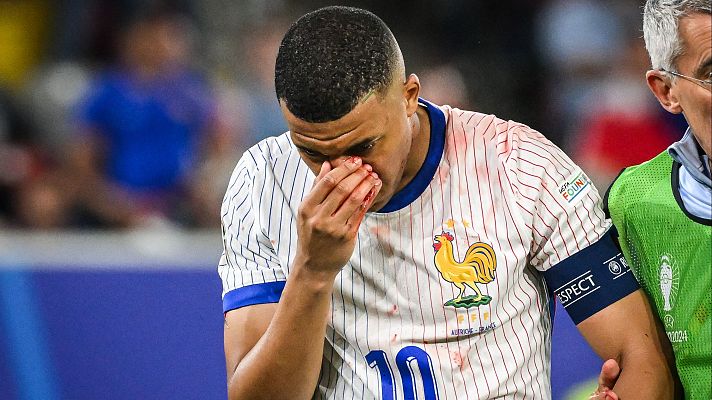 Mbappé se rompe la nariz tras chocar con Danso en el encuentro ante Austria