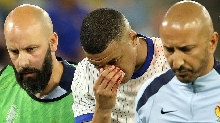 Mbappé no se operará la rotura de nariz y jugará con una máscara