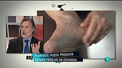 Para Todos La 2 - Debate: La psoriasis