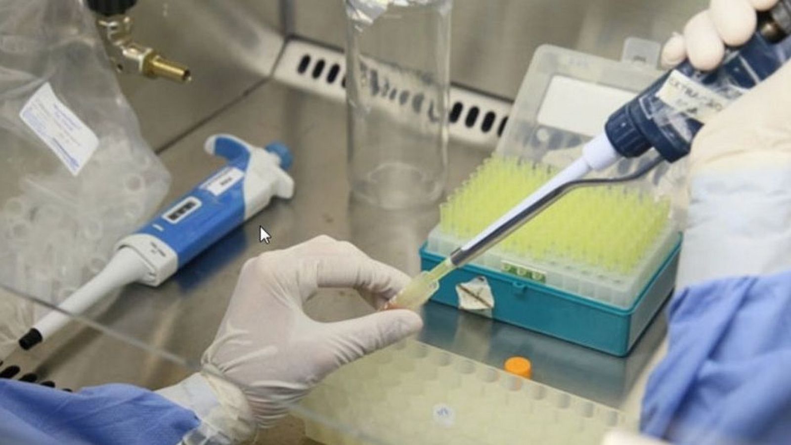 Las enfermedades tropicales repuntan en España | Ver