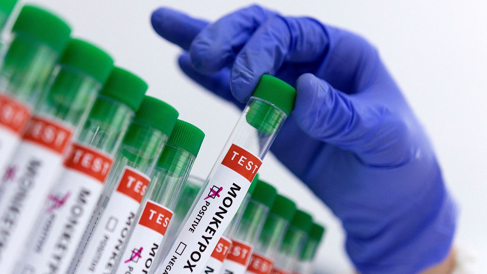 Europa valora el riesgo de contagio de mpox como "muy bajo" | Ver