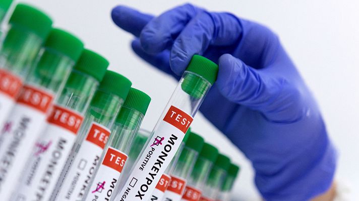 Telediario 1 - Europa cree "muy probable" que haya más casos de mpox, pero valora el riesgo de contagio como "muy bajo"