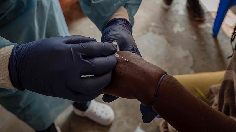 Mpox | La UE no recomienda controles en las fronteras | Ver