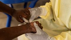 Bulos y falsedades de la mpox: no se disparan los casos en España y la OMS no ordena el confinamiento