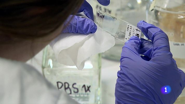 L'Informatiu - En el Dia Mundial de l'Alzheimer es reclama més suport per als malalts