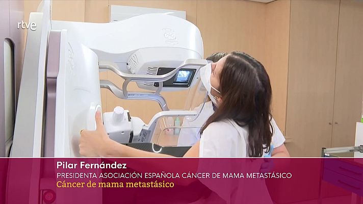 Cáncer de mama metastásico