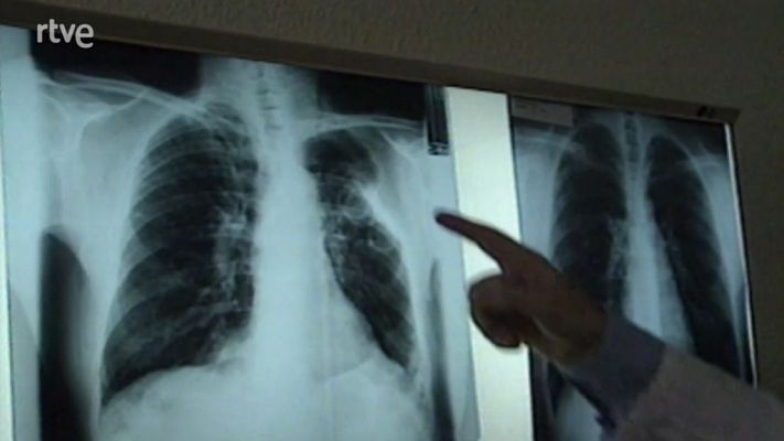 Els tècnics en Radiologia denuncien intrusisme professional