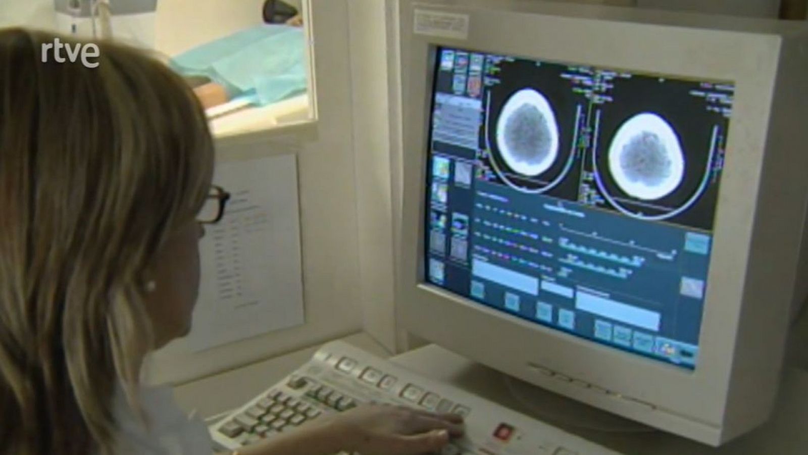 Teleradiologia - Catalunya avui - Arxiu TVE Catalunya - Catalunya avui | Veure