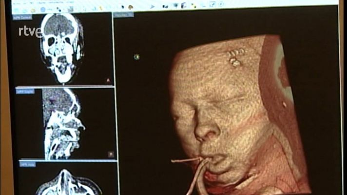 L'Informatiu - La radiologia compta amb un nou programa d'imatge digital