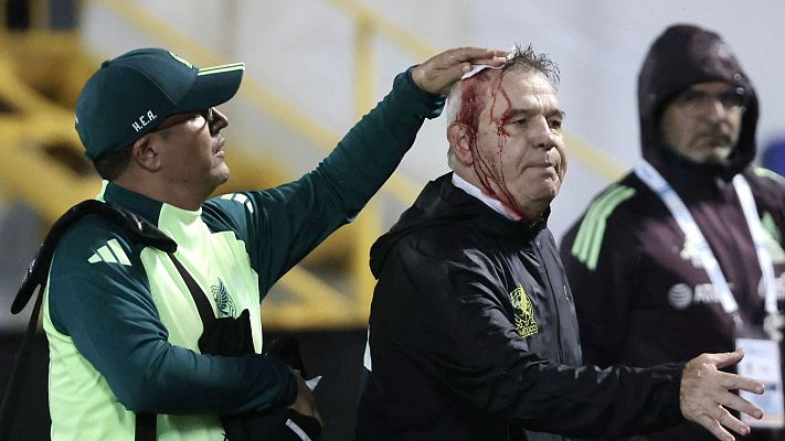  - Javier Aguirre sufre un botellazo en la cabeza tras el Honduras - México