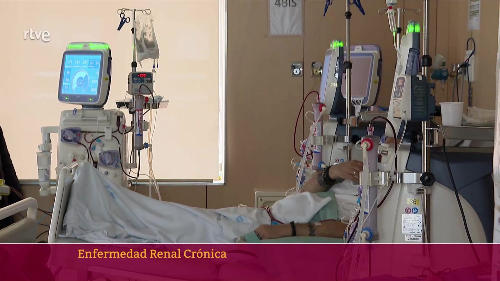 'Escucha el silencio' de la enfermedad renal crónica | Ver