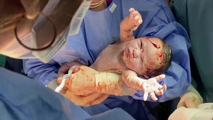 Telediario 1 - Las mejores imágenes del 2024 de los espectadores de Televisión Española