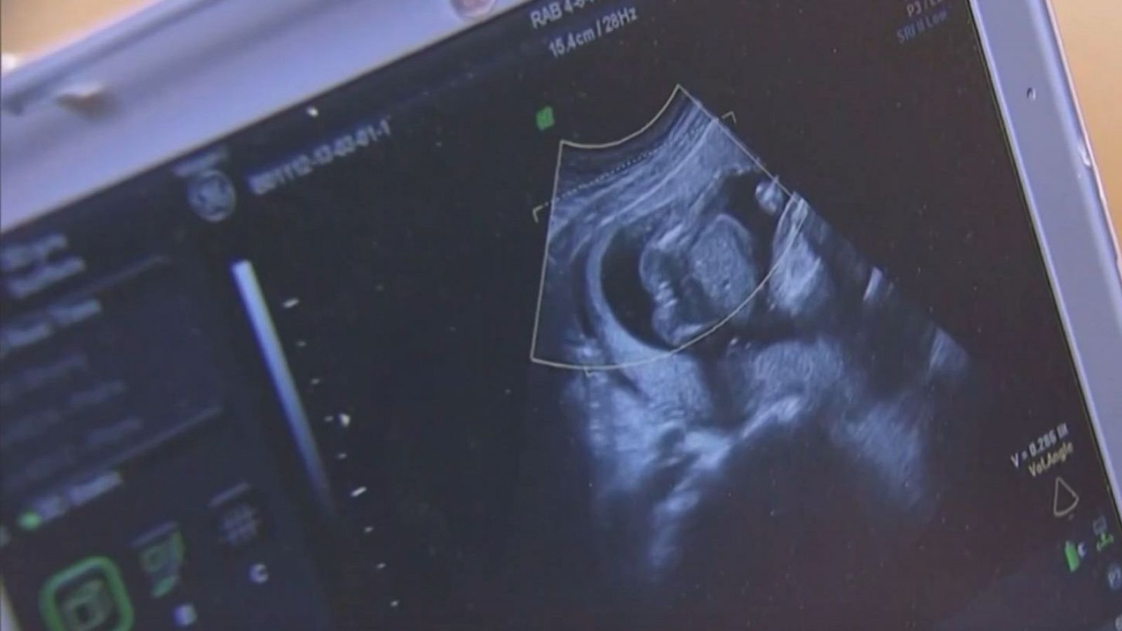 "Trump es responsable de las leyes antiabortivas" | Ver