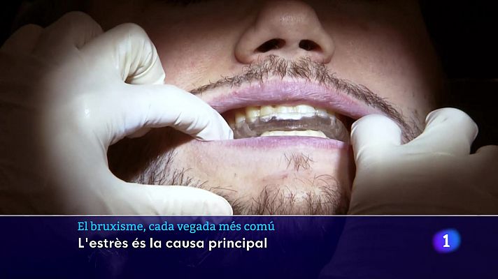 L'Informatiu - Mal de cap, oïdes i tensió a les galtes...el bruxisme, una afecció cada vegada més comú