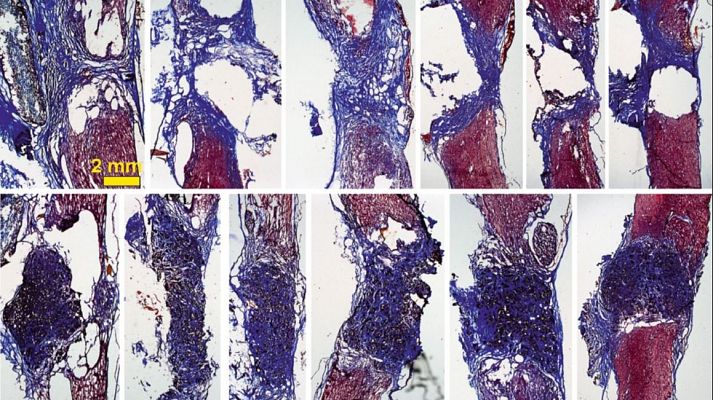 Científicos consiguen reconectar la columna totalmente partida de una rata