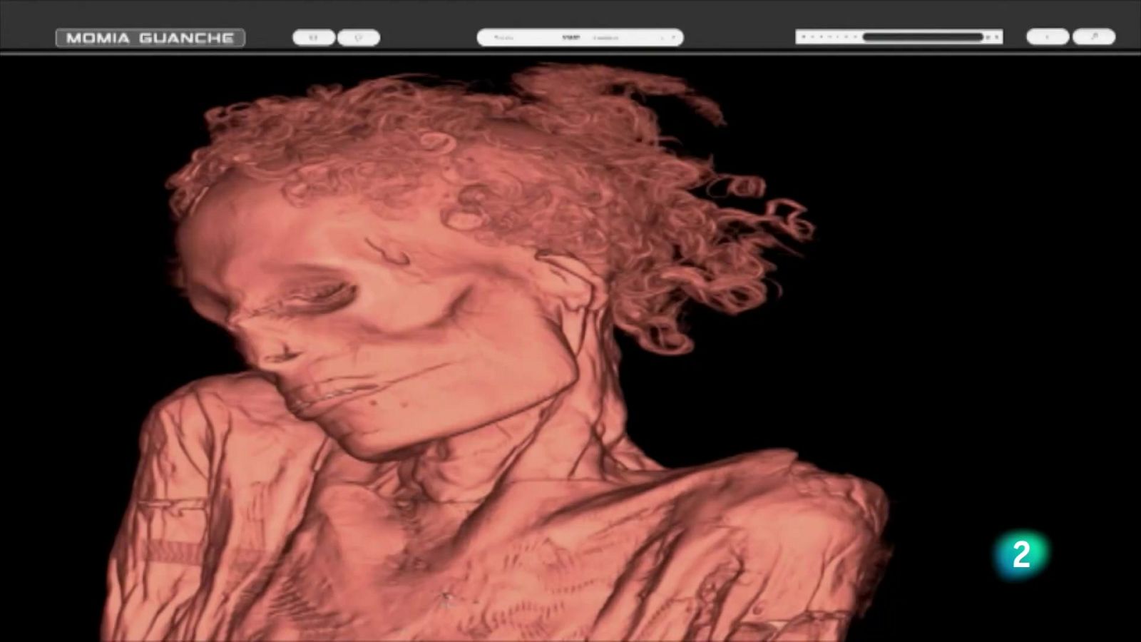 Telecanarias 2 - 24/02/2025 | Ver