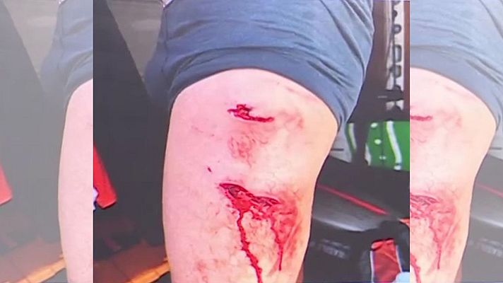 Mañaneros 360 - Ataque de un tiburón en Fuerteventura