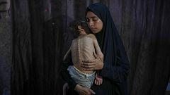 Médicos británicos regresan de Gaza con un grito de auxilio: "Están matando a los palestinos de hambre"