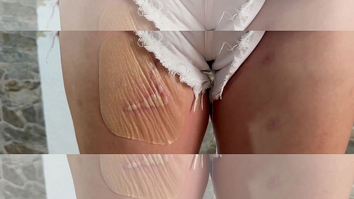 Mañaneros 360 - Arrestan a una mujer por retener tres días a otra y quemarle sus partes íntimas