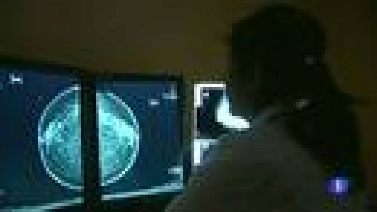 Tratamiento preventivo contra el cáncer de mama en Reino Unido