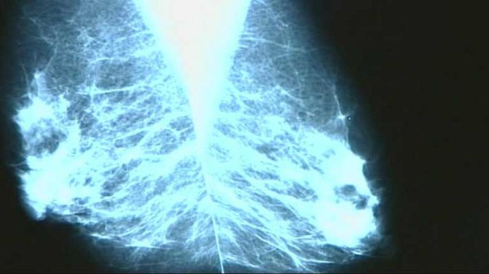 Telediario 1 - Tratamiento preventivo