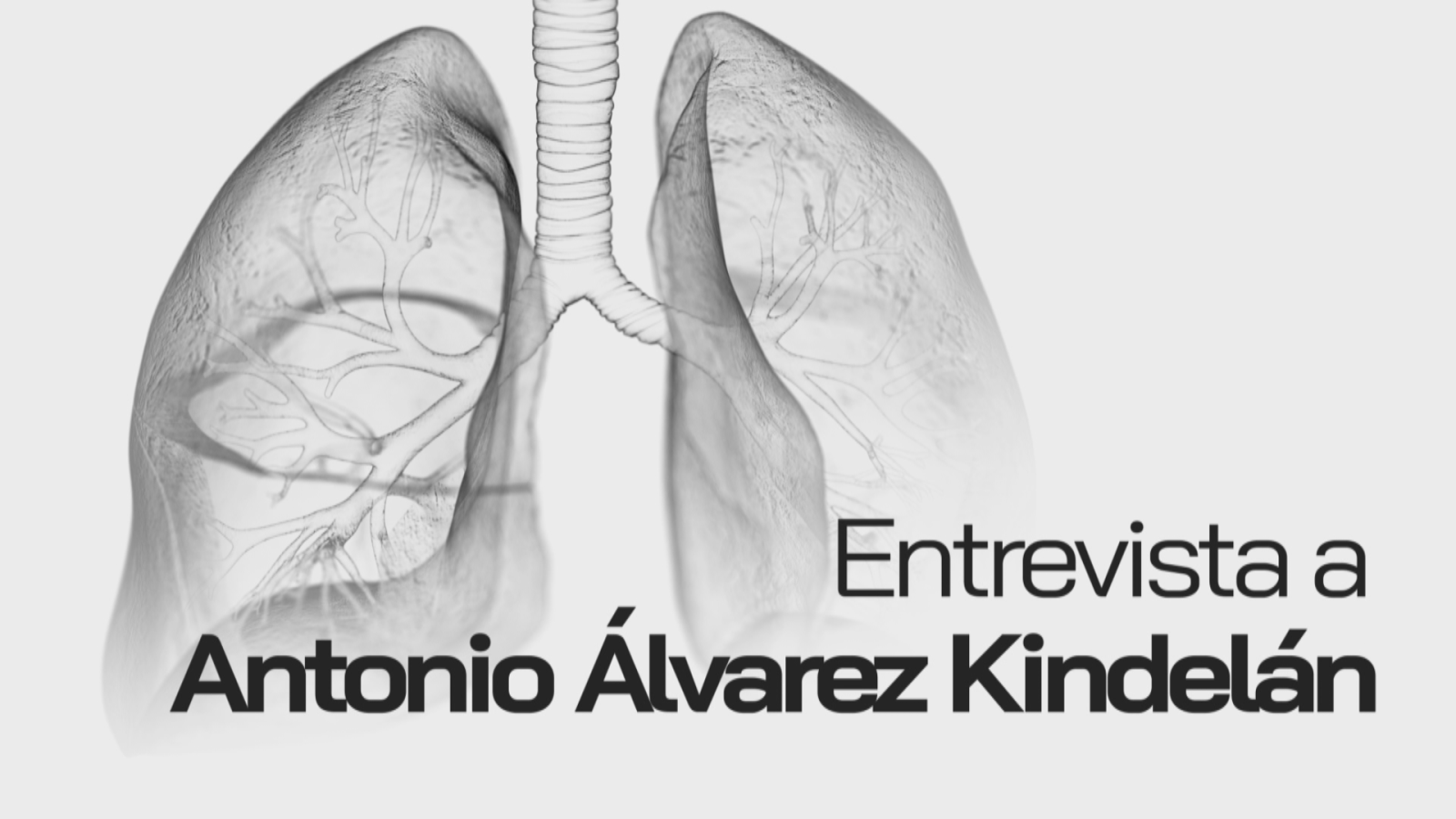 Entrevista a Antonio Álvarez Kindelán - Noticias Andalucía | Ver