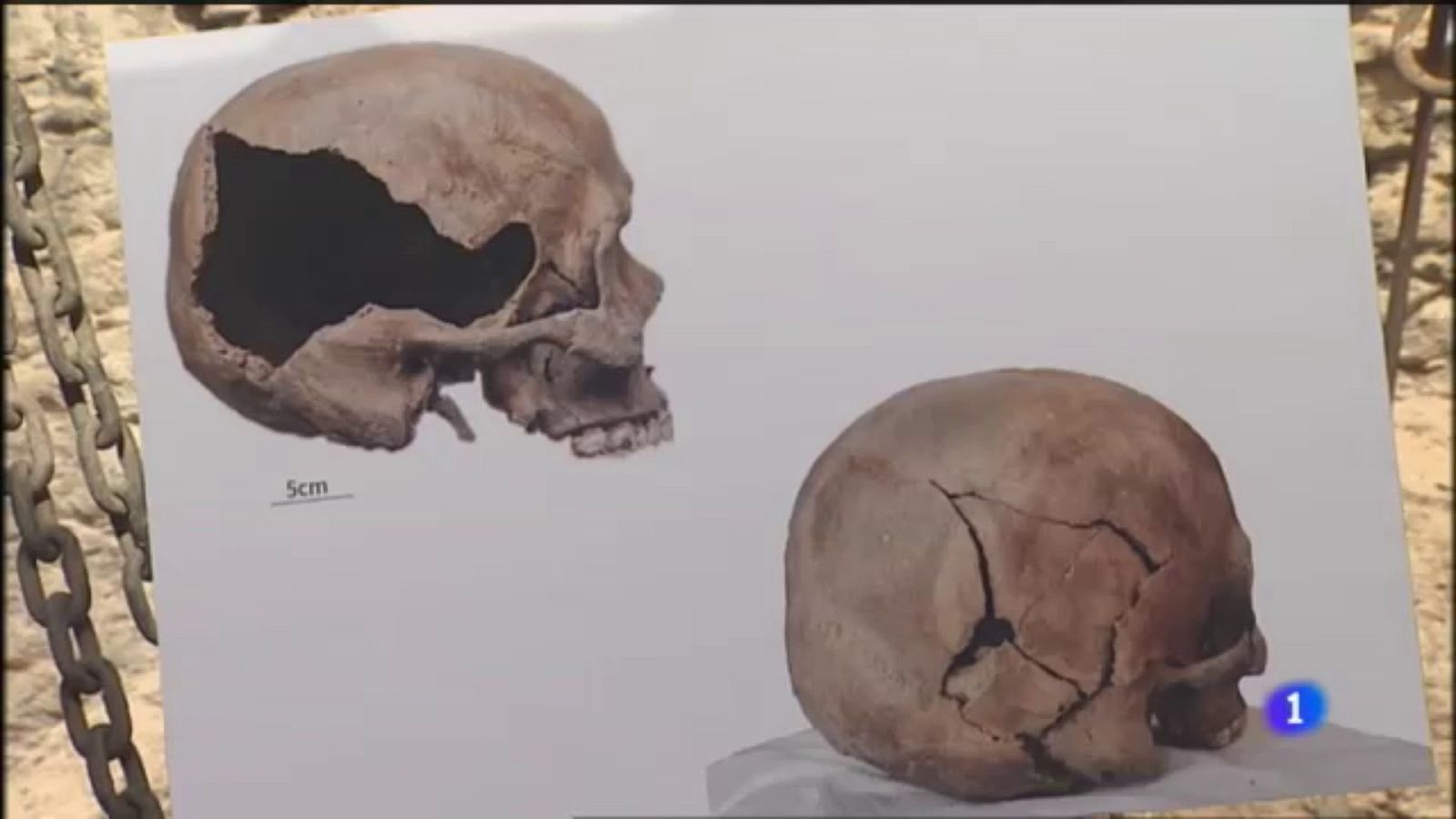 Recuperados más de 500 restos óseos en Pozo de Tenoya (Arucas) | Ver ahora