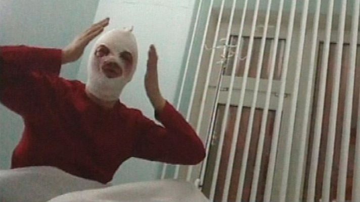 Telediario 1 - Ataque con ácido