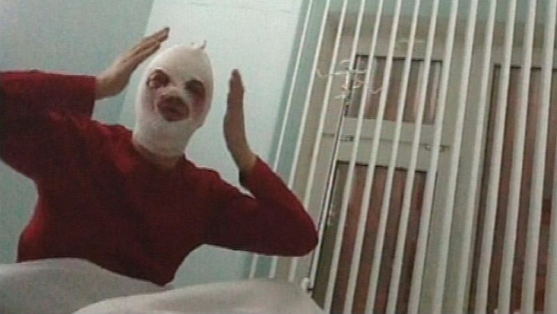 Atacan con ácido al director artístico del Teatro Bolshoi