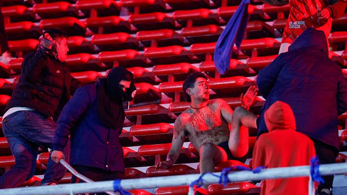 Los Deportes de La1 - Tres heridos graves, uno de ellos crítico, por los graves incidentes en el Independiente - Universidad de Chile