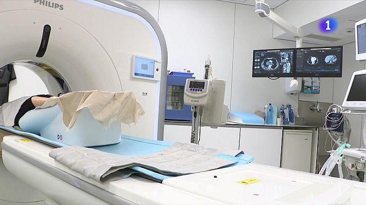 L'Informatiu - Un estudi eleva un 20% la supervivència del càncer de pulmó