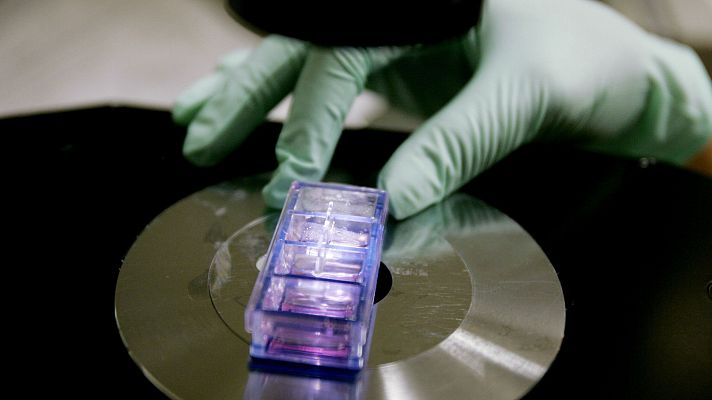 Telediario 1 - El linfoma, un cáncer cada vez más frecuente pero también con mejor tratamiento