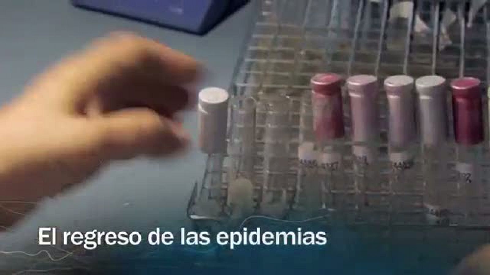 Redes - El regreso de las epidemias - avance