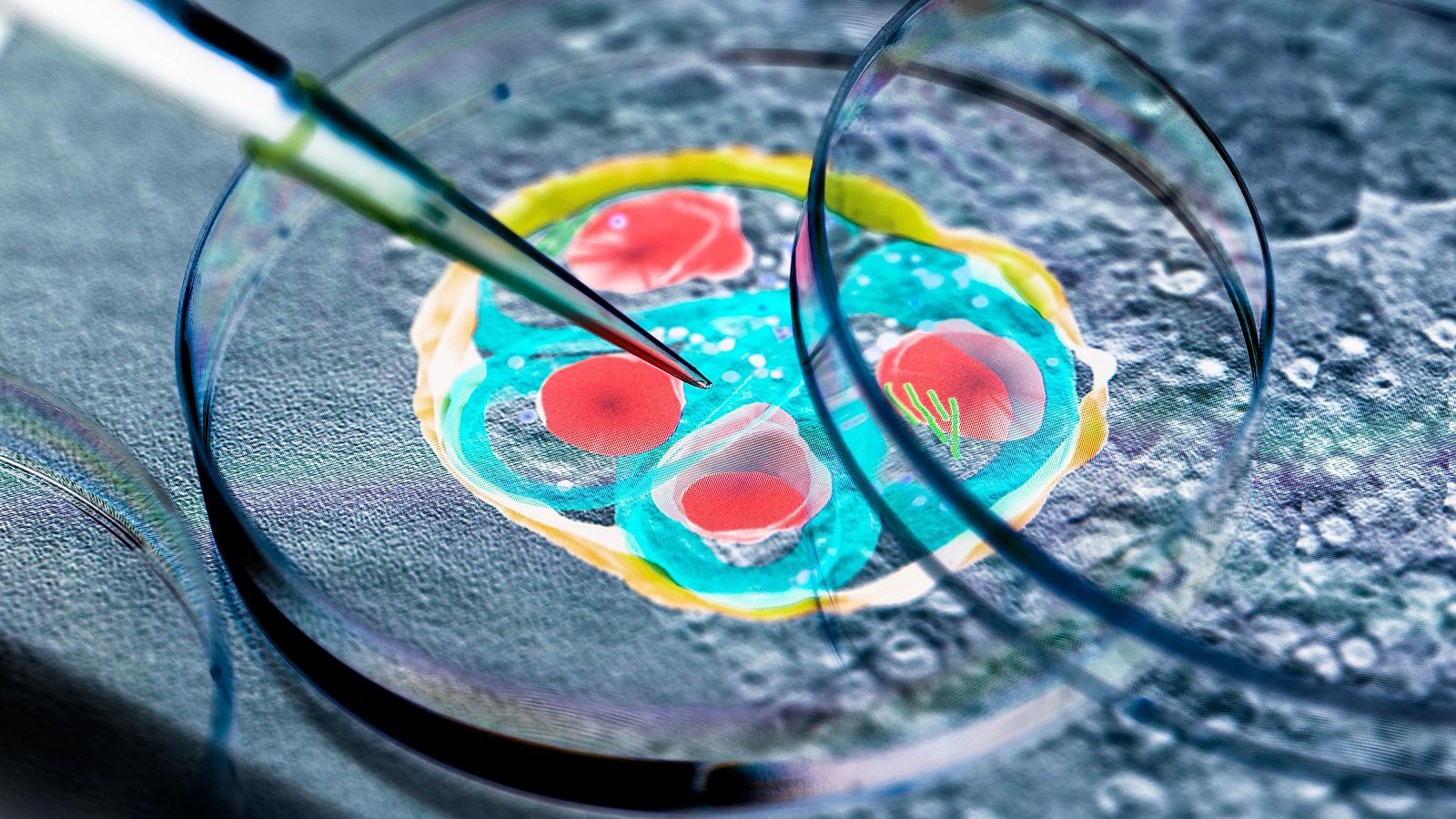 MultiplexAI, un proyecto para detectar la malaria con un móvil - La tarde en 24h | Ver