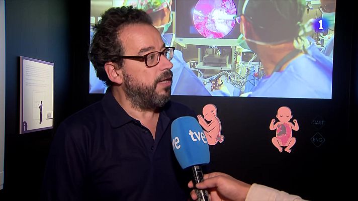 L'Informatiu - L'Hospital Vall d'Hebron celebra 70 anys d'història