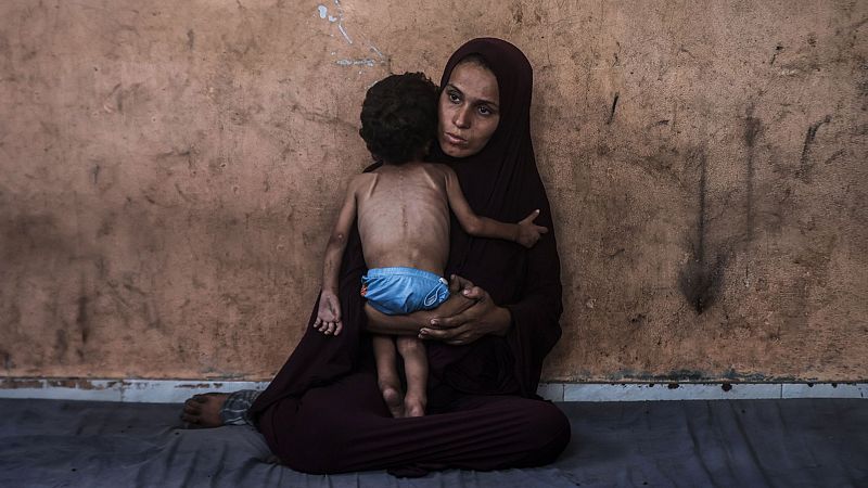 Los bloqueos de Israel disparan la desnutrición en Gaza | Ver