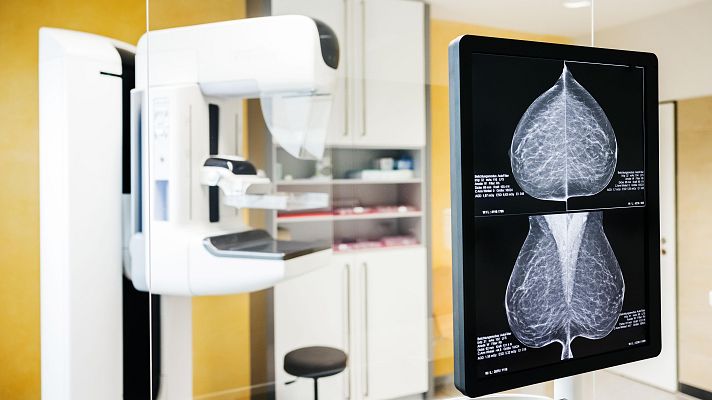 Telediario Fin de Semana - Errores en los cribados del cáncer de mama: "Estoy muerta en vida"