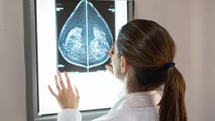 Un nuevo fármaco contra el cáncer de mama consigue reducir notablemente el riesgo de recaída