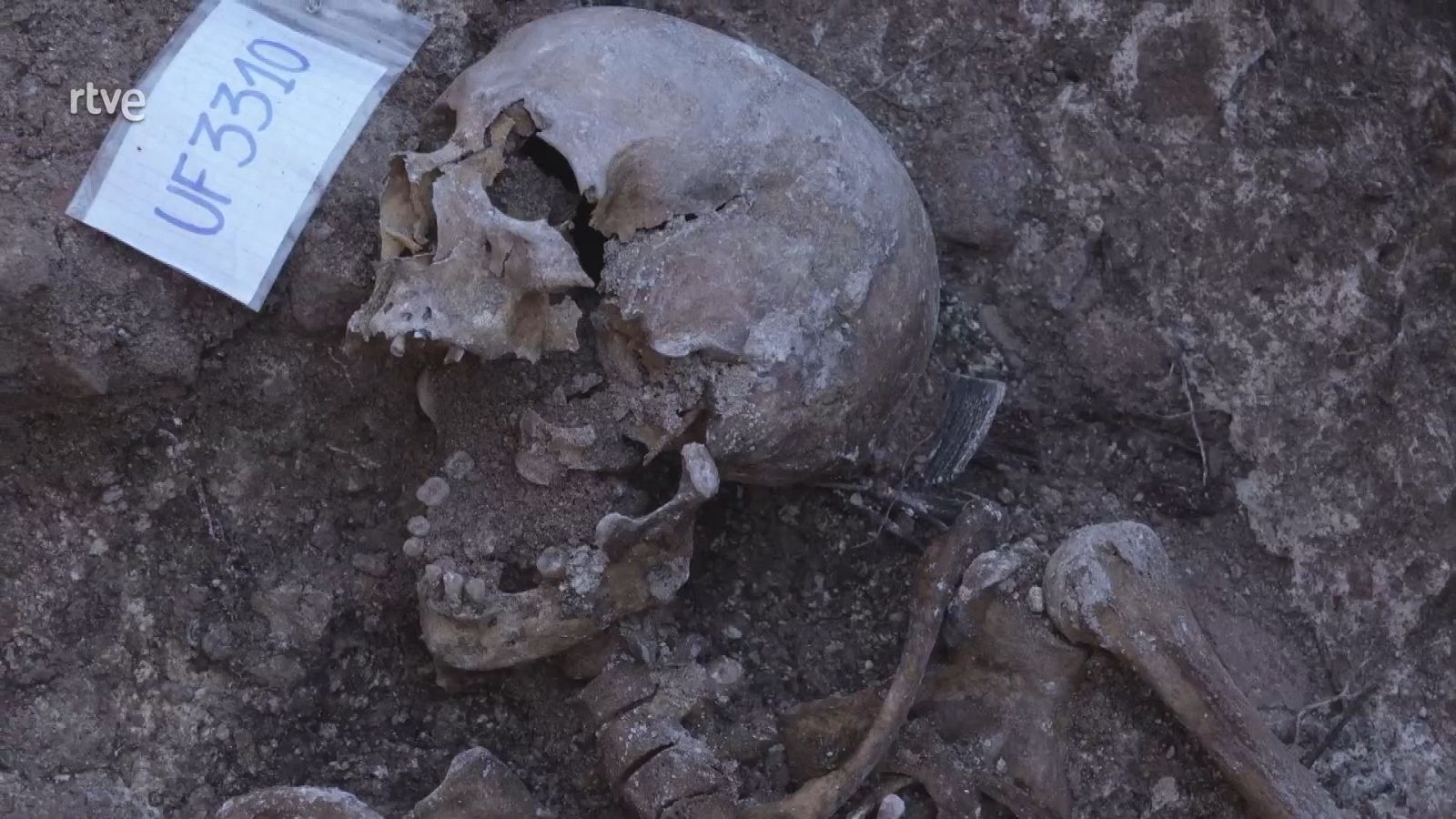 Exhumación de la 'fosa de las mujeres de Cella' o fosa de Albarracín III, Teruel | Ver ahora