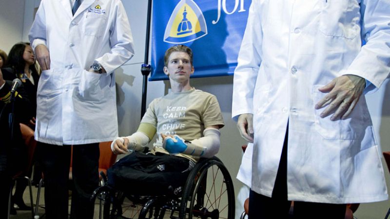 Brendan Marrocco recupera los brazos tras un trasplante