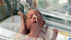 Comando actualidad - Milagro médico - Bebés prematuros