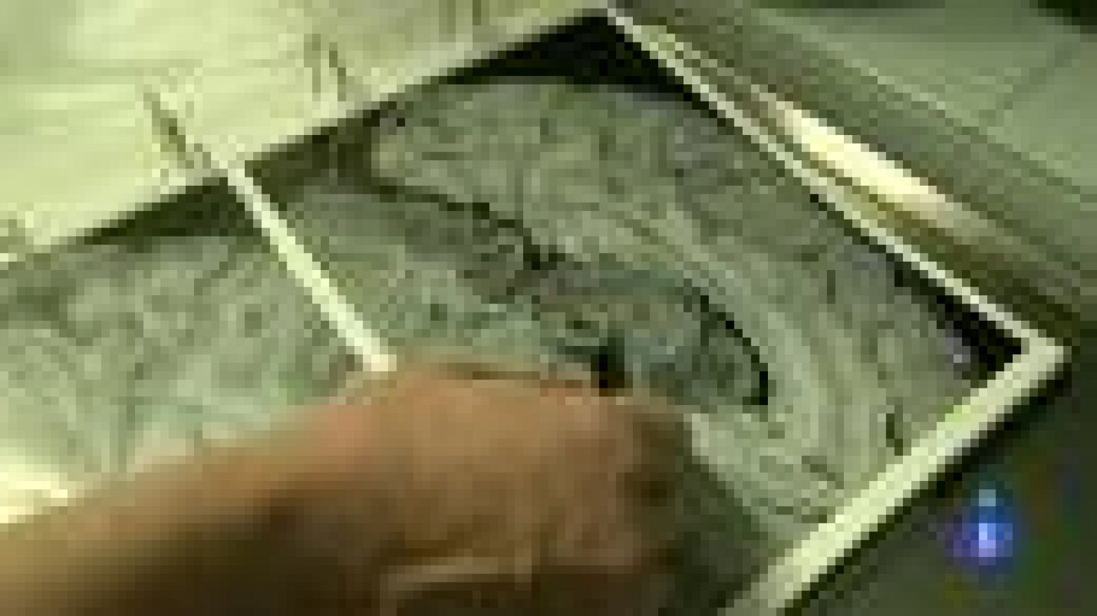 Comando actualidad - Milagro médico - Operación de electrodos - ver ahora