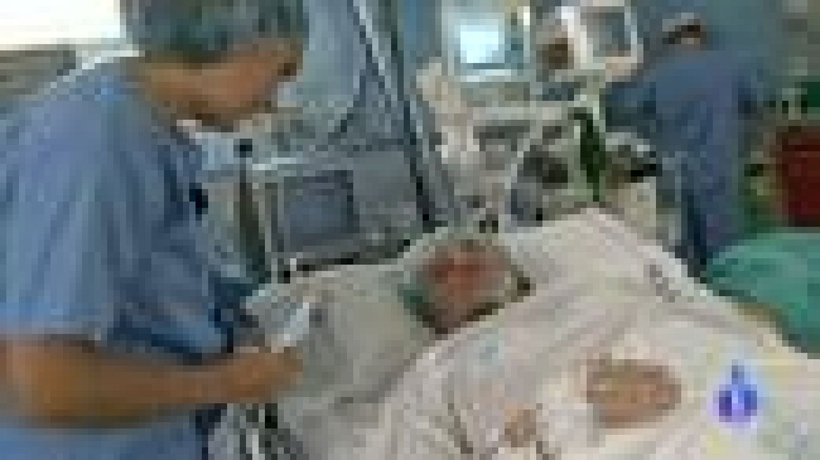 consecuencias de la cirugía de próstata con videos de robots