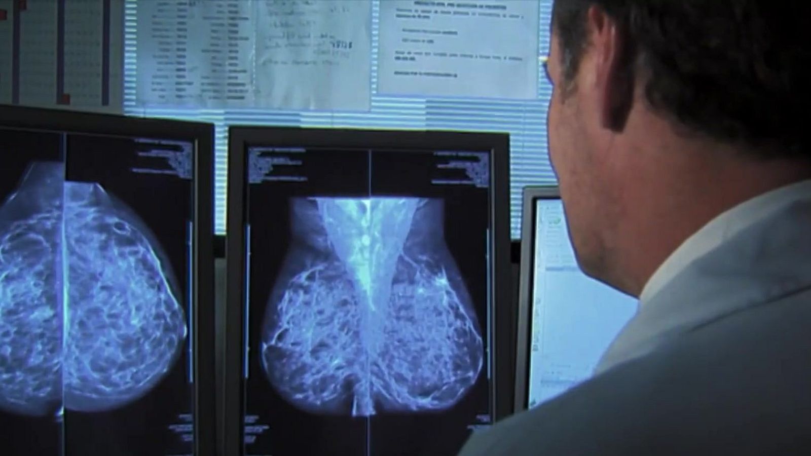 Congelen els cribratges de càncer - L'Altaveu al pati - L'altaveu al pati | Veure