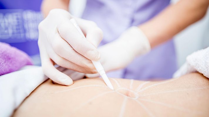 Telediario Fin de Semana - Intrusismo en la medicina estética