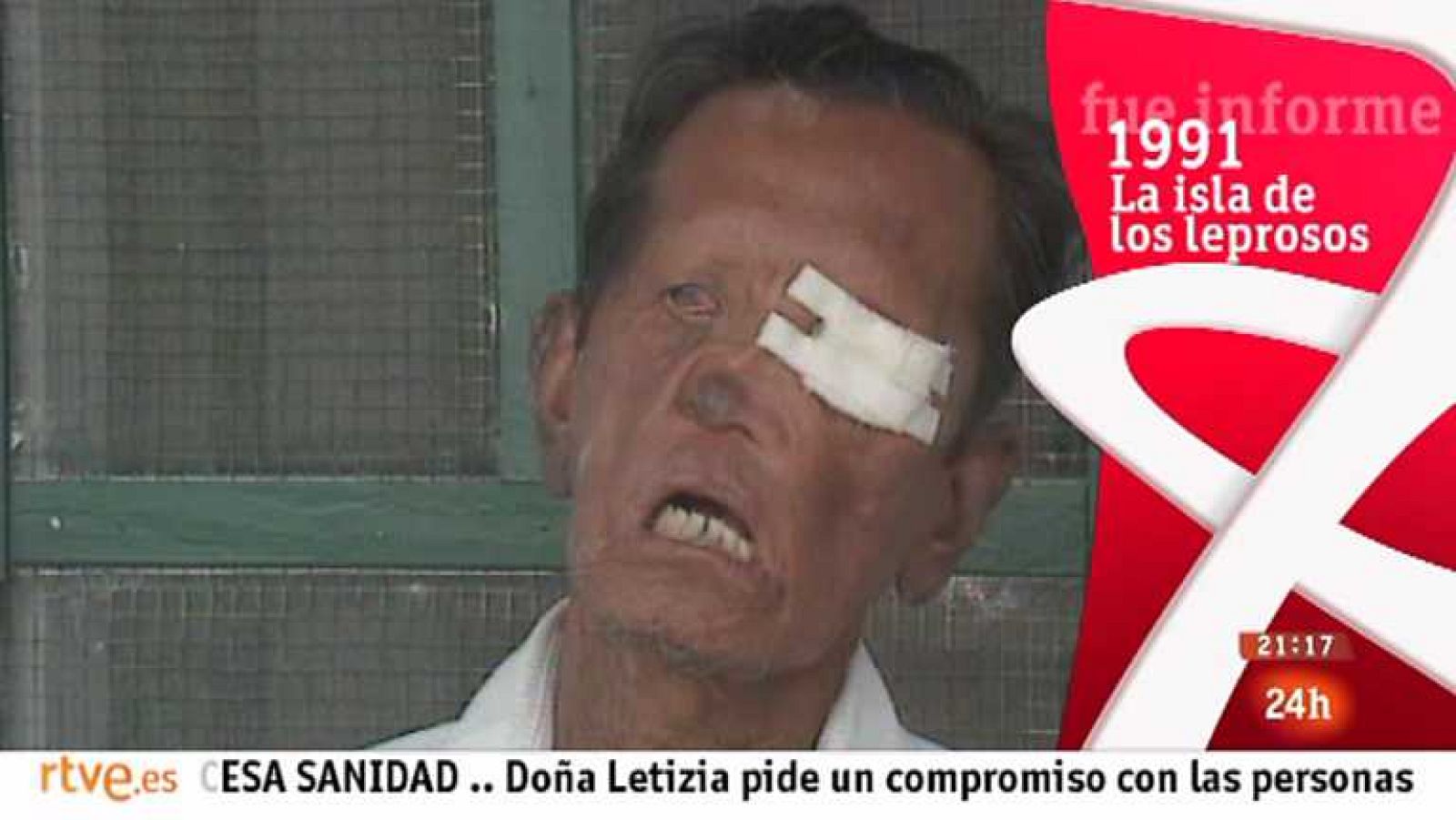 Fue Informe - La isla de los leprosos - Ver ahora