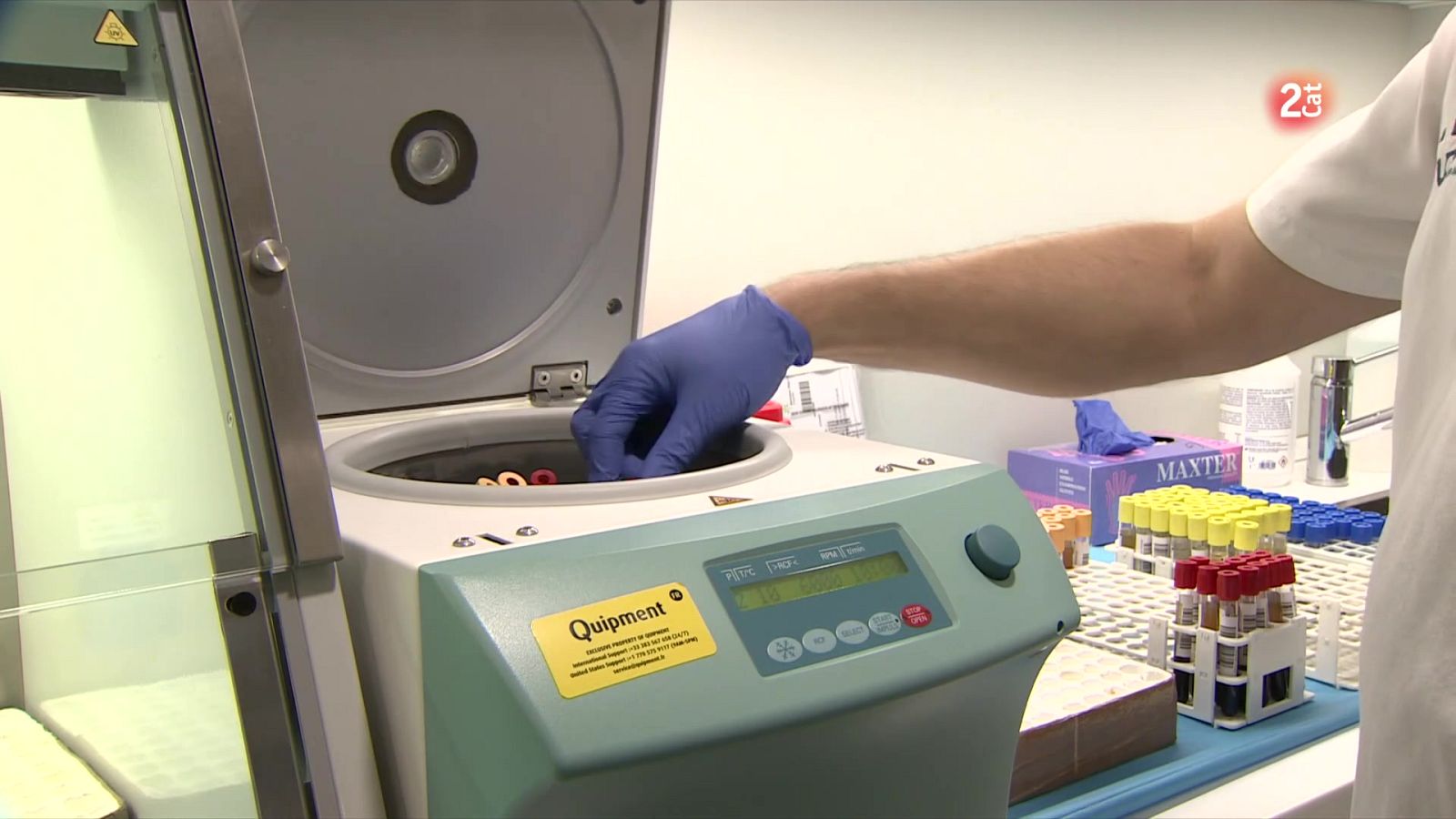 BCN Checkpoint alerta: llistes d’espera de 30 mesos per tractament preventiu del VIH