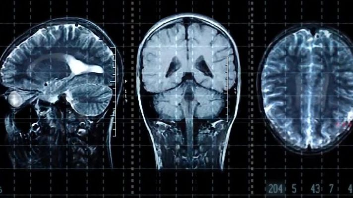 L'altaveu - Les cinc edats del cervell