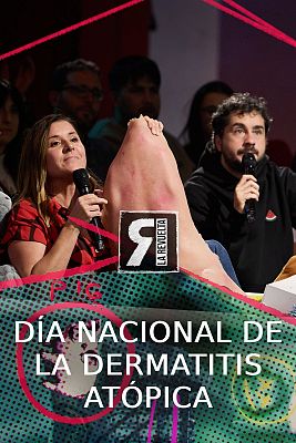 La Revuelta - Día Nacional de la Dermatitis Atópica